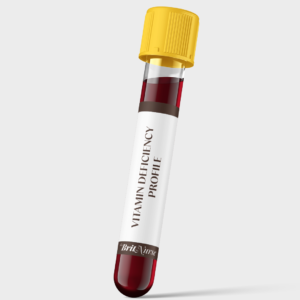 Vitamins Deficiency Profile